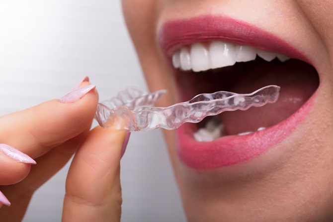 Férula dental