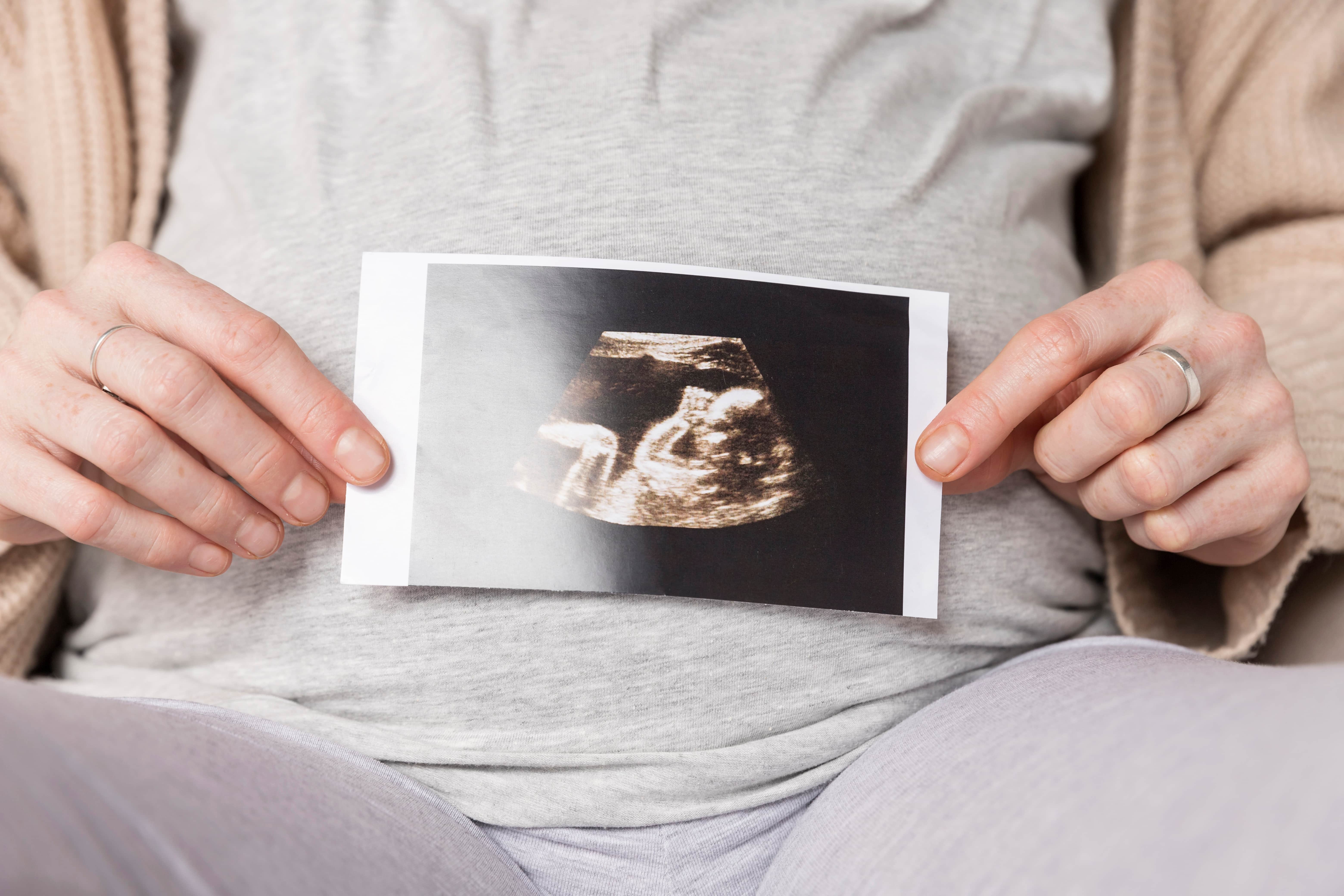 close up pregnant woman with ultrasound image 2