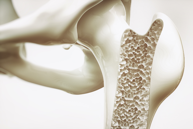 osteo